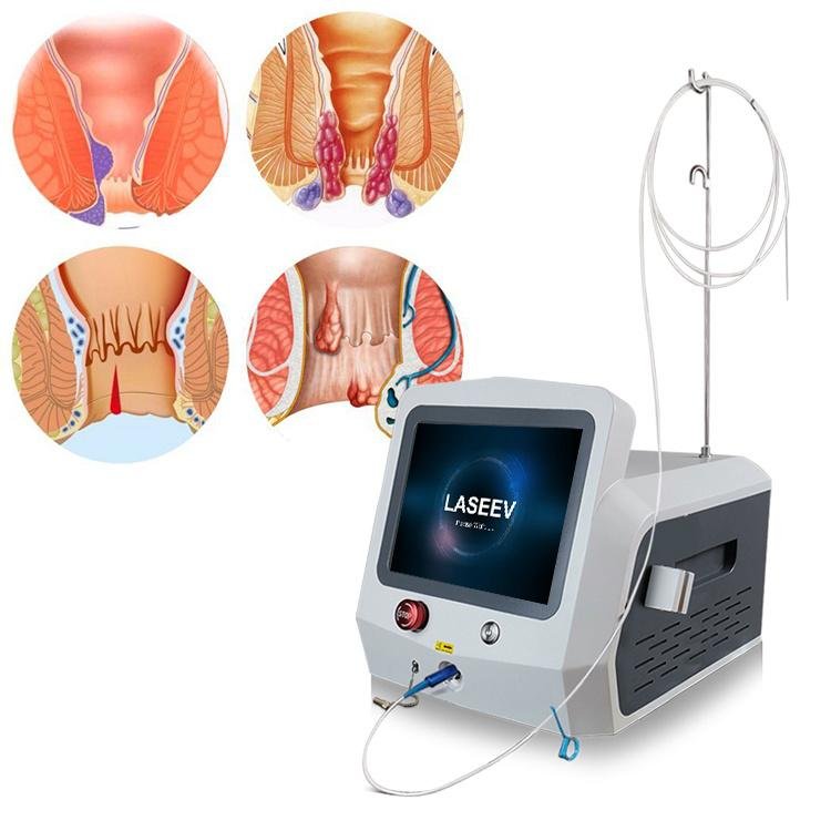 Laser Surgery (Piles, Fissure, Fistula)